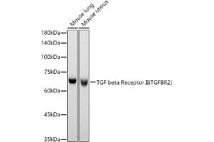 Western blot analysis of extracts of various cell lines, using TGF beta Receptor II (TGFBR2) antibody (ABIN6130736, ABIN6149086, ABIN6149089 and ABIN6218416) at 1:630 dilution.