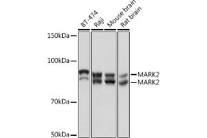 Western blot analysis of extracts of various cell lines, using M Rabbit mAb (ABIN7268397) at 1:1000 dilution.