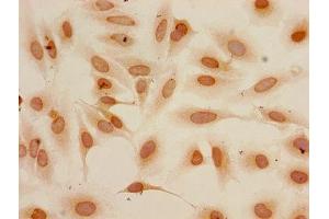 Immunocytochemistry analysis of Hela cells using ABIN7139278 at dilution of 1:100 (HIST1H3A anticorps  (H3K4me2))