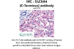 Image no. 1 for anti-Solute Carrier Family 5 (Low Affinity Glucose Cotransporter), Member 4 (SLC5A4) (C-Term) antibody (ABIN1739402)