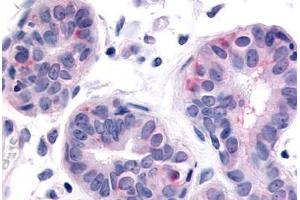 Anti-HUNK antibody  ABIN1048970 IHC staining of human breast. (HUNK anticorps  (Internal Region))
