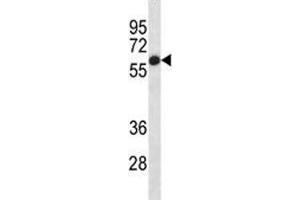Placental Alkaline Phosphatase antibody western blot analysis in HepG2 lysate (Alkaline Phosphatase anticorps  (AA 56-83))