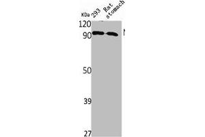 Western Blot analysis of rat stomach 293 cells using NPAS2 Polyclonal Antibody (NPAS2 anticorps  (Internal Region))