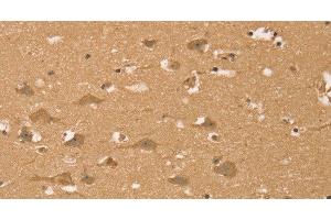 Immunohistochemistry of paraffin-embedded Human brain using HIF1AN Polyclonal Antibody at dilution of 1:40