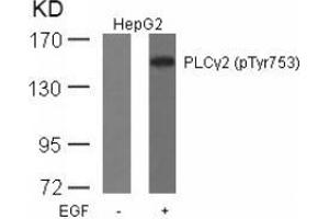Image no. 1 for anti-Phospholipase C gamma 2 (PLCG2) (pTyr753) antibody (ABIN196906) (Phospholipase C gamma 2 anticorps  (pTyr753))