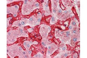 Anti-CLEC4M / L-SIGN / CD299 antibody IHC staining of human liver.