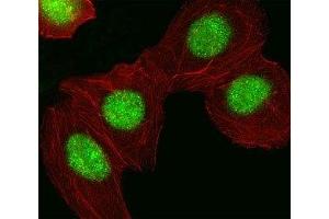 Fluorescent image of A549 cell stained with HMGA1 antibody at 1:25. (HMGA1 anticorps  (AA 64-93))