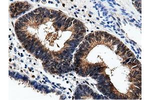 Immunohistochemical staining of paraffin-embedded Human Kidney tissue using anti-AK5 mouse monoclonal antibody. (Adenylate Kinase 5 anticorps)