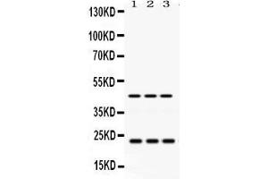 Anti- RAB13 Picoband antibody, Western blottingAll lanes: Anti RAB13  at 0.