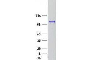 Validation with Western Blot