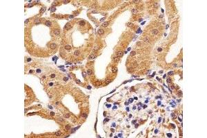 Immunohistochemical analysis of paraffin-embedded rat kidney section using VEGFR3 antibody at 1:25 dilution.