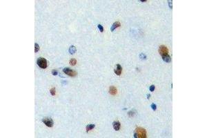 Immunohistochemical analysis of TEF staining in human brain formalin fixed paraffin embedded tissue section.