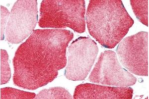 Rabbit Anti-KCNJ12 antibody  Formalin Fixed Paraffin Embedded Tissue: Human Adult Skeletal muscle  Observed Staining: Cytoplasm in hepatocytes Primary Antibody Concentration: 1:600 Secondary Antibody: Donkey anti-Rabbit-Cy3 Secondary Antibody Concentration: 1:200 Magnification: 20X Exposure Time: 0.