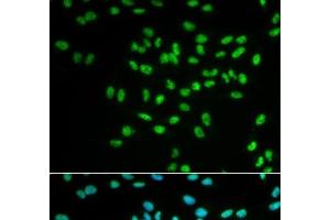 Immunofluorescence analysis of MCF-7 cells using FANCD2 Polyclonal Antibody (FANCD2 anticorps)