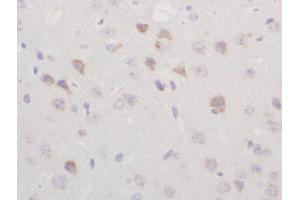 Formalin-fixed and paraffin embedded rat brain labeled with Rabbit Anti-TGM2 Polyclonal Antibody, Unconjugated  at 1:200 followed by conjugation to the secondary antibody and DAB staining