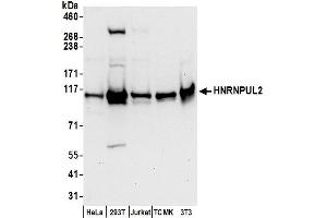 Western Blotting (WB) image for anti-Heterogeneous Nuclear Ribonucleoprotein U-Like 2 (HNRNPUL2) (AA 25-75) antibody (ABIN7450335)