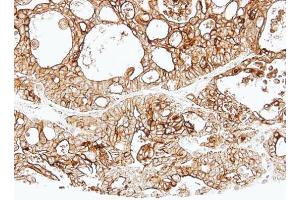 IHC-P Image Immunohistochemical analysis of paraffin-embedded human Breast, using ALPPL2, antibody at 1:500 dilution. (ALPPL2 anticorps  (Center))