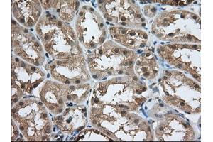 Immunohistochemistry (IHC) image for anti-Acetyl-CoA Acetyltransferase 2 (ACAT2) antibody (ABIN1496397) (ACAT2 anticorps)