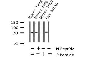 Western blot analysis of Phospho-DRP-2 (Thr514) expression in various lysates (DPYSL2 anticorps  (pThr514))