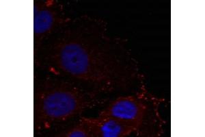 Immunofluorescence staining of methanol-fixed Hela cells using Paxillin(phospho-Tyr88) Antibody. (Paxillin anticorps  (pTyr88))