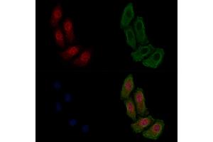 ABIN6255221 and ABIN6267478 staining HepG2 cells(4h of LPS treatment) by IF/ICC.