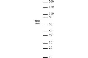 Lamin A/C mAb (Clone 3A6-4C11) tested by Western blot. (Lamin A/C anticorps  (AA 430-545))