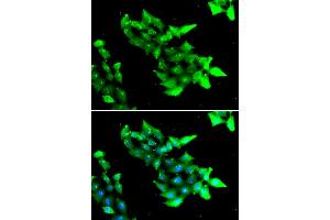 Immunofluorescence analysis of HeLa cells using KRIT1 antibody (ABIN5974145). (KRIT1 anticorps)