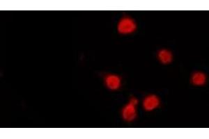 ABIN6272320 staining Hela by IF/ICC. (HDAC9 anticorps  (C-Term))