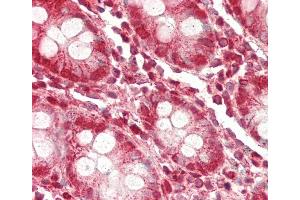 Formalin-fixed and paraffin-embedded H.