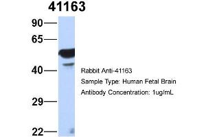 Host: Rabbit   Target Name: 41163   Sample Tissue: Human Fetal Brain  Antibody Dilution: 1.