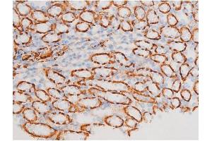 ABIN6267523 at 1/200 staining Mouse kidney tissue sections by IHC-P.