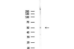 Western blot analysis of lysates from  cells(starvation,24h treatment), using Phospho-PKA-R2 beta (Ser114) Antibody at 1/1000 dilution.