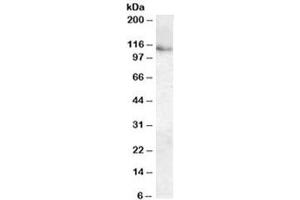 Western blot testing of human kidney lysate with ATP13A1 antibody at 0. (ATP13A1 anticorps)