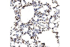 IHC analysis of RCC1 using anti-RCC1 antibody (ABIN7600024). (RCC1 anticorps  (AA 14-421))