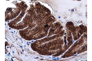 IHC-P Image E-Cadherin antibody detects E-Cadherin protein at cell membrane and cytoplasm in mouse prostate by immunohistochemical analysis. (E-cadherin anticorps)