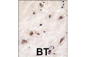 Formalin-fixed and paraffin-embedded human brain tissue reacted with GDF1 antibody (N-term), which was peroxidase-conjugated to the secondary antibody, followed by DAB staining.