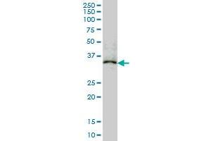 MAPRE2 monoclonal antibody (M03), clone 4D7 Western Blot analysis of MAPRE2 expression in K-562 .