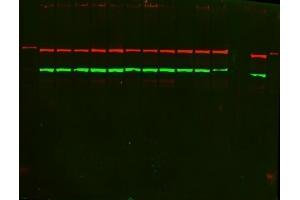 Western blot analysis of PKC alpha/PRKCA using anti-PKC alpha/PRKCA Antibody (ABIN3043549).