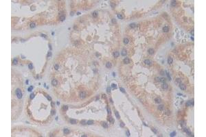 Detection of RARS in Human Kidney Tissue using Polyclonal Antibody to Arginyl tRNA Synthetase (RARS) (RARS anticorps  (AA 1-146))