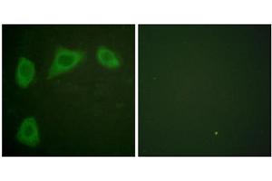 Immunofluorescence analysis of HuvEc cells, using Caveolin 1 antibody. (Caveolin-1 anticorps  (C-Term))