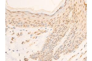 ABIN6267069 at 1/100 staining human skin tissue sections by IHC-P.