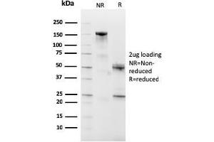 SDS-PAGE Analysis Purified CD10 Mouse Monoclonal Antibody (MME/2590).