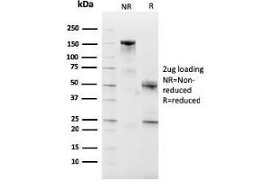 SDS-PAGE Analysis Purified CD10 Mouse Monoclonal Antibody (MME/2590). (MME anticorps  (AA 297-483))