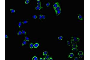 Immunofluorescent analysis of HepG2 cells using ABIN7172023 at dilution of 1:100 and Alexa Fluor 488-congugated AffiniPure Goat Anti-Rabbit IgG(H+L) (Peroxiredoxin 3 anticorps  (AA 63-256))