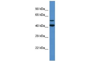 Western Blotting (WB) image for anti-Glutamate Decarboxylase-Like 1 (GADL1) (Middle Region) antibody (ABIN2774262) (GADL1 anticorps  (Middle Region))