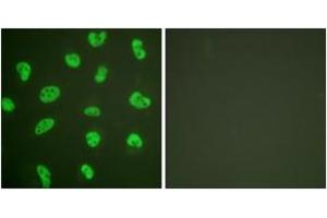 Immunofluorescence analysis of HeLa cells, using DNA-PK Antibody. (PRKDC anticorps  (AA 4061-4110))