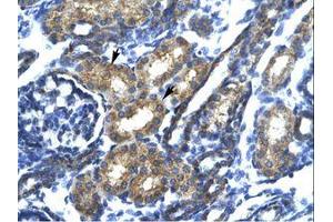 Image no. 2 for anti-SP140 Nuclear Body Protein (SP140) (AA 39-88) antibody (ABIN202038) (SP140 anticorps  (AA 39-88))