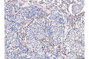 IHC analysis of Acid Phosphatase/ACP5 using anti-Acid Phosphatase/ACP5 antibody (ABIN7601574). (ACP5 anticorps  (AA 39-325))