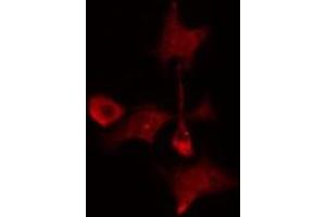 ABIN6275218 staining  Hela cells by IF/ICC. (MAD2L1BP anticorps  (N-Term))