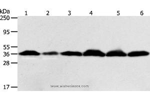 Western blot analysis of Hela cell and human liver cancer tissue, Raji, Jurkat, 293T and PC3 cell, using APEX1 Polyclonal Antibody at dilution of 1:450 (APEX1 anticorps)